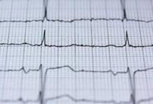 nova pulse strategic orbital legacy